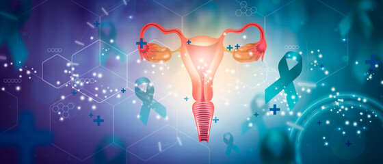 자궁선근증의 원인과 증상 예방 및 치료 방법